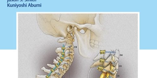Cervical Spine Deformity Surgery – eBook PDF