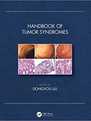 Handbook of Tumor Syndromes – eBook PDF