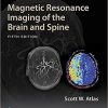 Magnetic Resonance Imaging of the Brain and Spine (5th Edition) – eBook PDF