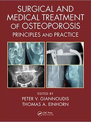 Surgical and Medical Treatment of Osteoporosis: Principles and Practice – eBook PDF