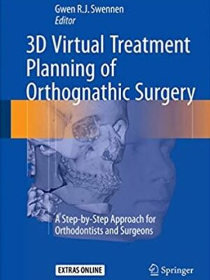 3D Virtual Treatment Planning of Orthognathic Surgery Gwen Swennen, ISBN-13: 978-3662473887