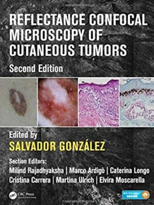 Reflectance Confocal Microscopy of Cutaneous Tumors 2nd Edition, ISBN-13: 978-1498757607