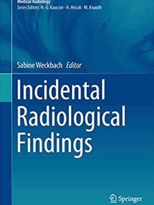 Incidental Radiological Findings Sabine Weckbach, ISBN-13: 978-3319425795