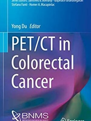 PET/CT in Colorectal Cancer 1st Edition Yong Du, ISBN-13: 978-3319548364