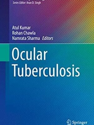 Ocular Tuberculosis 2017 Edition Atul Kumar, ISBN-13: 978-3319575193