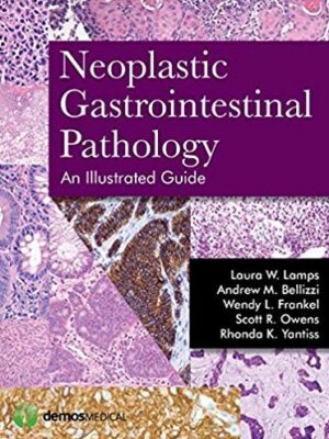 Neoplastic Gastrointestinal Pathology: An Illustrated Guide, ISBN-13: 978-1936287727