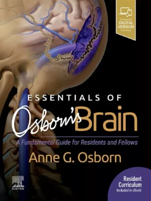 Essentials of Osborn’s Brain – PDF